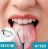 MeeTo Stainless Steel Tongue Cleaners, Tongue Scraper for Fresh Breath With Metal Case (Pack of 1) view 2