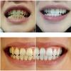 Activated Charcoal Toothpaste for Teeth Whitening ? Natural, Fluoride-Free Formula for Fresh Breath & Deep Cleaning-Stain Removal for a Brighter, Healthier Smile view 2