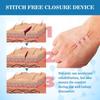 ATORSE Emergency Wound Closure Device Emergency Stitches Bandage for Tear First Aid view 4