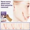 ATORSE Scar Removal Silicone Scar Strips for Burn Scars Scar Patch Multi Use Soft view 2