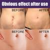 ATORSE Scar Removal Silicone Scar Strips for Burn Scars Scar Patch Multi Use Soft view 4