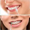Street27 40 Pcs Interdental Brush Ultra Tight Bristles Tooth Flossing Head Oral Dental Hygiene Brush Tooth Pick Flosser Toothpick Sticks For Teeth Oral Dental Care Brush Cleaning Tool - 40pcs set view 3