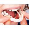 NavaFresh Basics Silicone Upper/Lower False Teeth Dental Veneers Dentures Fake Tooth Upper view 2