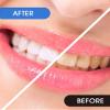 25 Pcs Interdental Brush for Teeth, Can Be Replaced L-Shape Interdental Brush Flosser for Teeth Clean Toothbrush Seam Brush Brush Orthodontics (Orange) view 4