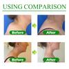 Hump Relief Patches  Wormwood Cervical Care Patch for Shoulder Strain, Lumbar Spine, and Back Discomfort (12pcs) view 4