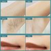 IGNOTI Laser Hair Removal with Ice Cooling Care Function for Women Permanent Flashes Painless IPL Hair Remover, Hair Removal Device for Armpits Legs Arms Bikini Line view 3