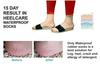 ADIVAN-waterproof Rubber Socks, Anti Crack Gel Heel Ankle Length And Foot Protector Moisturizing Socks for Foot Care,Pain Relief for Men And Women(1 PAIR)(SKIN BROWN) (M) view 4