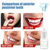 BAZPUR MART 3ml Temporary Tooth Repair Kit Fix Teeth Filling Gap Material Care view 3