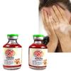 Aloe Vera Extract Vitiligo Cream Gel, Remove Vitiligo On Lips, Ringworm White Spot, White Patches, Even Skin Tone, Vitiligo Cream CREAM. view 1