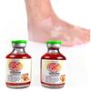 Aloe Vera Extract Vitiligo Cream Gel, Remove Vitiligo On Lips, Ringworm White Spot, White Patches, Even Skin Tone, Vitiligo Cream CREAM. view 2