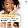 Aloe Vera Extract Vitiligo Cream Gel, Remove Vitiligo On Lips, Ringworm White Spot, White Patches, Even Skin Tone, Vitiligo Cream CREAM. view 4