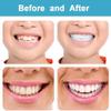 KLVS Snap-On Instant Smile Veneers Comfortable Fit Flex Dentures for Upper & Lower Teeth, Bright White for a Natural, Neat Smile view 3