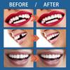 MERISHOPP 25G Temporary Tooth Repair Kit Teeth Gaps Falseteeth for Teeth Veneer Broken view 2
