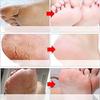 Foot Peel Mask for Dead Skin Removal Dry Cracked Callus Remover Hydrating Sock Deeply Moisturizes Dry & Dull Skin Reduces Pigmentation Make Your Feet Baby Soft Repair Rough Heels - Lavender Essence view 4
