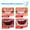 CALANDIS Fruit Flavor Baking Soda Toothpaste Strong Cleaning Stain Blueberry | Toothpaste | Oral Care view 2