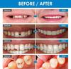 DEEPARTH Snap-On Instant Perfect Smile Veneers Comfortable Flex Fit Dentures for Top & Bottom| Tooth Cosmetic Cover Comfort Fit Flex Dentures for White Neat Smile view 3