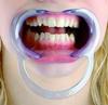 Cheek Retractor C Type Adult Pack Of 3 Piece view 2