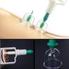 12 Cups Set for Cellulite Cupping Massager Holistic Wellness Solution view 2