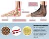 black sparrow Foot Angel Anti-Fatigue Compression Foot Sleeve for Plantar Fasciitis Relief Copper Ankle Brace for Women Men Plantar Fasciitis Relief Sprained Ankle Ankle Support Reduce view 3