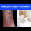 4-Layer Compression Bandage for Venous Leg Ulcers - JOMED view 4