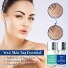 YELURI PRODUCTSSkin Tag & Mole Remover Serum Fast-Acting Natural Formula for Clear, Smooth, Even-Toned Skin 10ml view 4