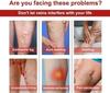 24 Patches Varicose Veins Patches Skin-Friendly Non-Toxic Improve Varicosity Vein Relieve reduce Swelling Pain Instant Relief From Muscular Pain & Joint Pain view 4