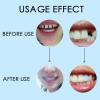 CALANDIS 3xDental Thermal Beads Teeth Veneers Moldable Denture Temporary Tooth Repair 100g | Oral Care view 3