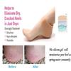 AARISH SAYA Anti Crack Silicone Gel Heel Pad Socks For Heel Swelling, Pain Relief, Cracked Heels Repair, Foot Care For Both Men & Women 1 Pair(2PCS) (Free Size). S11 view 2