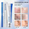 Acne Scar Removal Cream Stretch Mark & Dark Spot Treatment for Face & Body view 2