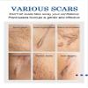 Acne Scar Removal Cream Stretch Mark & Dark Spot Treatment for Face & Body view 4