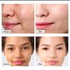 Avocado Night Brightening Face Cream | For Dark Spots, Uneven Skin Tone, Removes Pigmentation, Removes Pimples | Night Brightening Cream (20gm) view 4