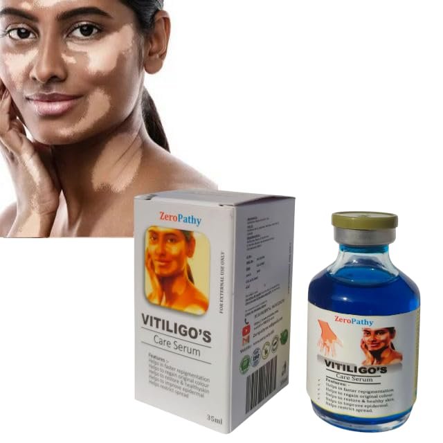 Ayurvedic Intimate area Vitiligo Cream with Natural Ingredients like Aloe, Turmeric, and Saffron, Helps Restore Healthy Skin, Reduces White Spots & Provides a Brighter and Even Skin Tone