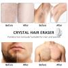 Drumstone (   ) Hair Remover with Nano-Crystalline Dots  No Irritation, Easy to Clean, and Ideal for Body Use-   view 3
