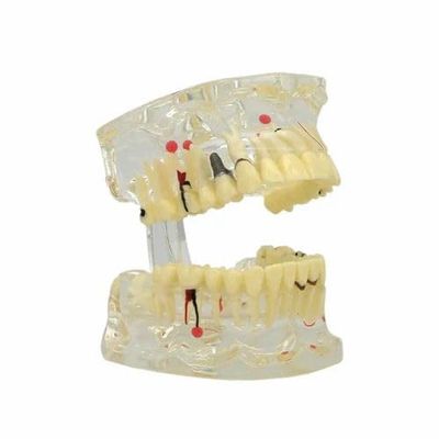 Dental Educational Model Teeth Set Pack Of 1 Piece