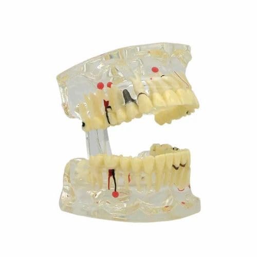 Dental Educational Model Teeth Set Pack Of 1 Piece