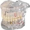 Dental Educational Model Teeth Set Pack Of 1 Piece view 2