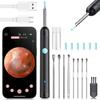 2025 Upgraded Visual Ear Cleaner with 1080P HD Camera & 6 LED Lights, Ear Wax Removal Tool with 6 Ear Spoon for Adults/Kids,Waterproof, 360 Rotating Safe Design, Type-C Fast Charging(Black) view 1