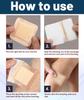 6 PCS Silicone Foam Dressing Waterproof Bandage, Bed Sore Patch, Dressing, Bandages for Wounds, Adhesive for Fast Healing, Dressing Pad for Bed Sores 7.5cm x 4.5cm view 4