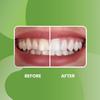 Acroveda Herbal Toothpaste | Whitening & Gum Care | Ayurvedic Toothpaste for Sensitivity Relief, Bad Breath, Cavity | Natural Herbs Neem,Tulsi & Babool | Fluoride & SLS Free | 100gmx3 (Pack of 3) view 4