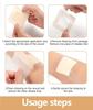4Pcs Hydrocolloid Bandages, Waterproof Bandage, Dressing Bandage Suitable for Most Skin Types(7.5 * 7.5CM) view 4