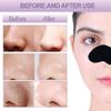 Trendy Styler Nose Strips, Blackhead Remover Remover & Pore Cleanser Skincare Cleansing Charcoal Patch Peel Off Nose Sticker for Women and man (PACK OF 5) view 2