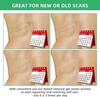 Advanced Silicone Scar Removal Gel 30g  Effective Treatment for Keloid, Acne, Burn, Surgery & Stretch Marks | Smooth Skin Care Solution for All Skin Types view 4